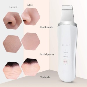 Facial Spatula Machine Face Ultrasonic Skin Scrubber